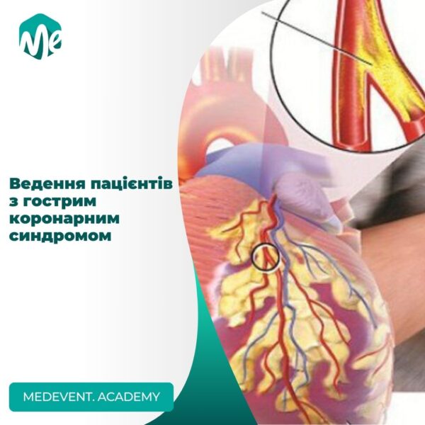 Ведення пацієнтів з гострим коронарним