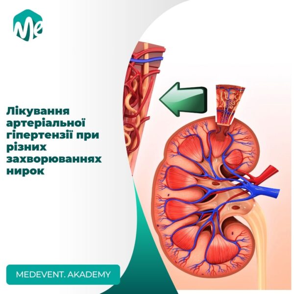 Лікування артеріальної гіпертензії при різних захворюваннях нирок