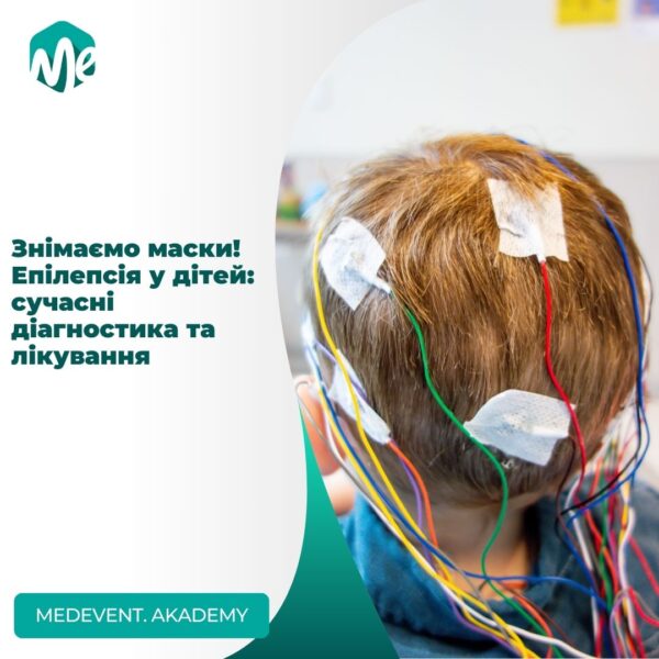 Знімаємо маски! Епілепсія у дітей: сучасні діагностика та лікування