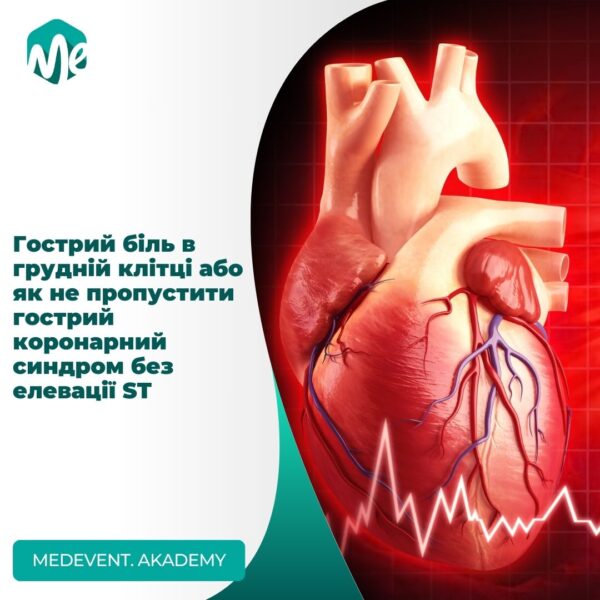 Гострий біль в грудній клітці або як не пропустити гострий коронарний синдром без елевації st