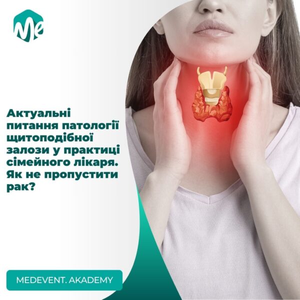 Актуальні питання патології щитоподібної залози у практиці сімейного лікаря. Як не пропустити рак?