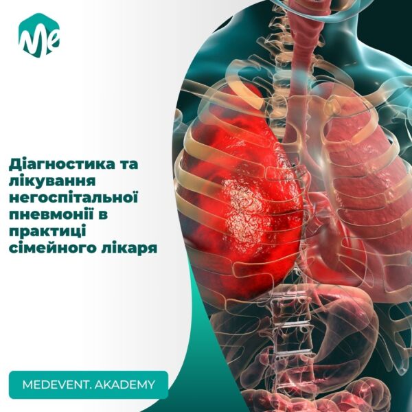 Діагностика та лікування негоспітальної пневмонії