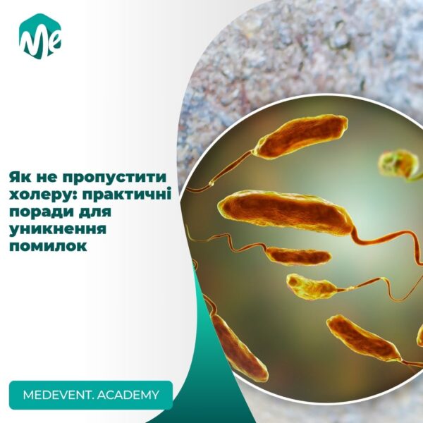 Як не пропустити холеру