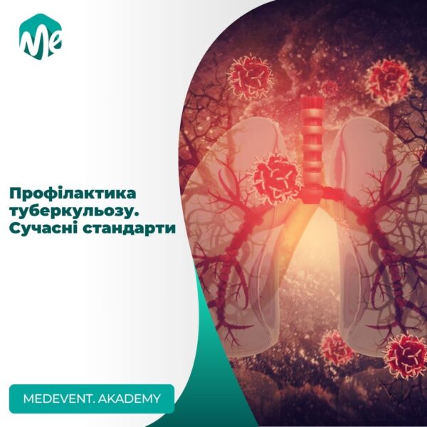 Профілактика туберкульозу. Сучасні стандарти