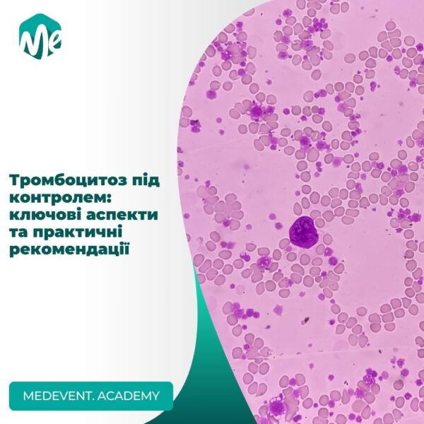 Тромбоцитоз під контролем