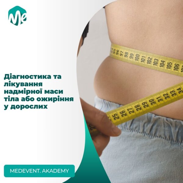 Діагностика та лікування надмірної маси