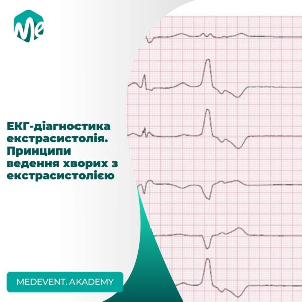 Екг-діагностика екстрасистолія. Принципи ведення хворих