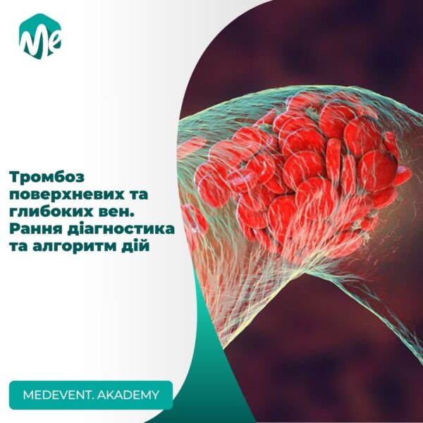 Тромбоз поверхневих та глибоких вен