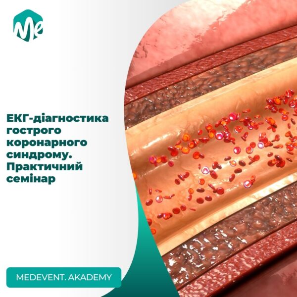 Екг діагностика гострого коронарного синдрому. Практичний семінар
