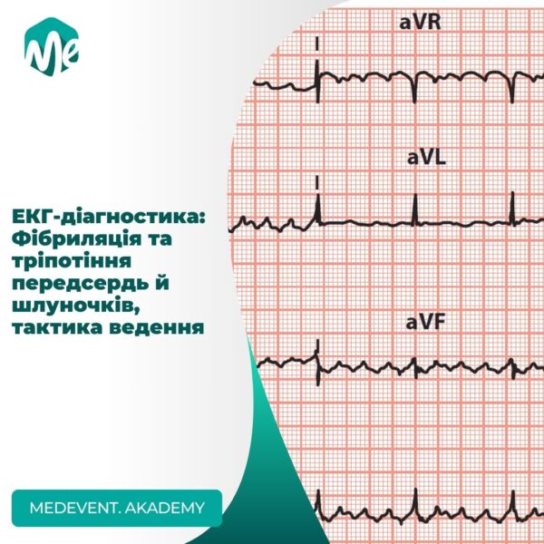 Екг-діагностика: фібриляція та тріпотіння передсердь