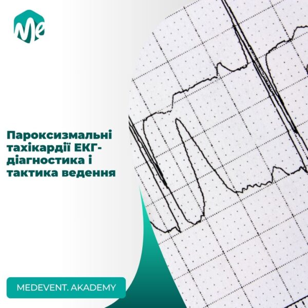 Пароксизмальні тахікардії: екг-діагностика і тактика