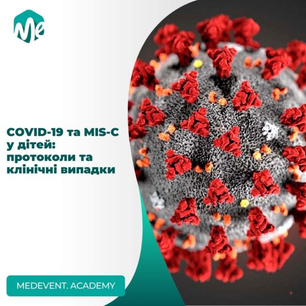 Covid-19 та mis-c у дітей
