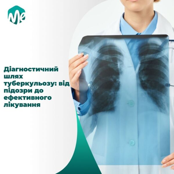 Діагностичний шлях туберкульозу: від підозри