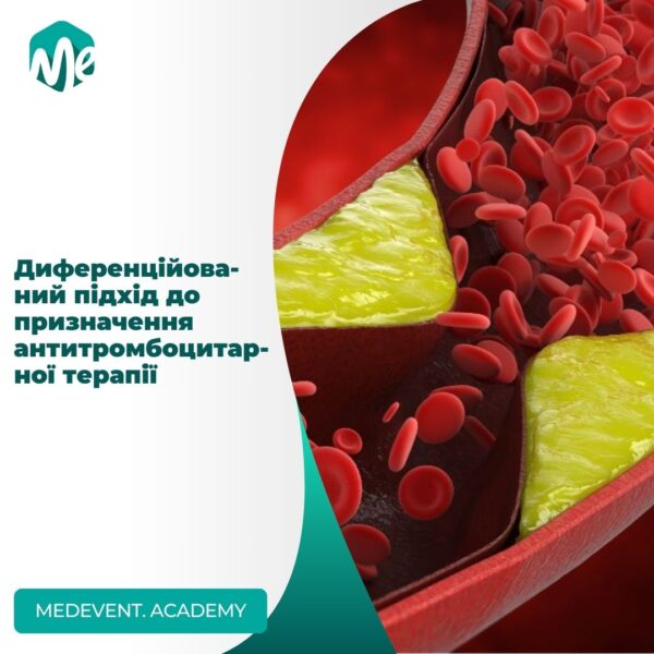 Диференційований підхід до призначення антитромбоцитарної