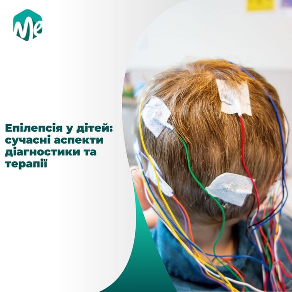 Epilepsiia u ditej 1