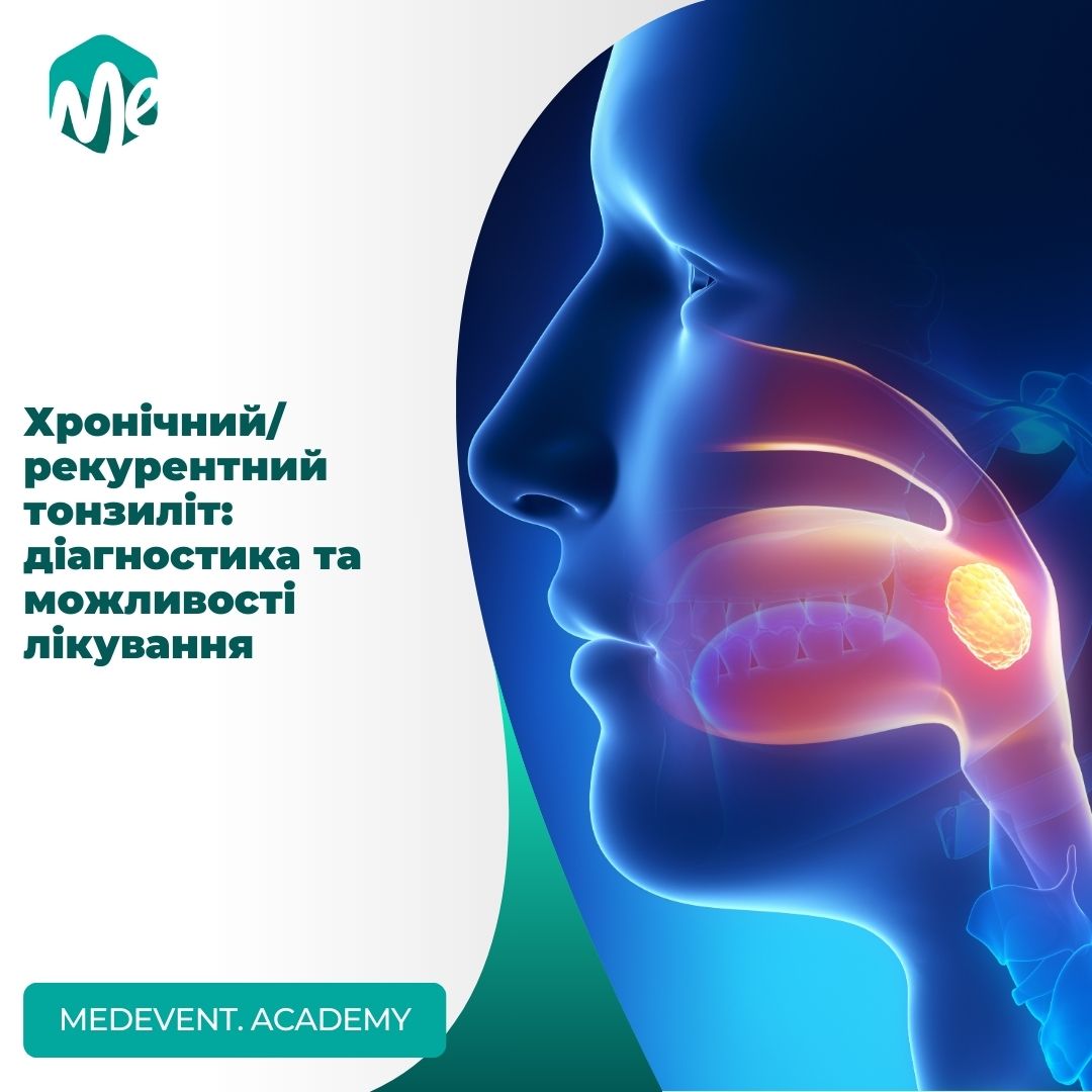 Хронічний/рекурентний тонзиліт: діагностика та можливості лікування