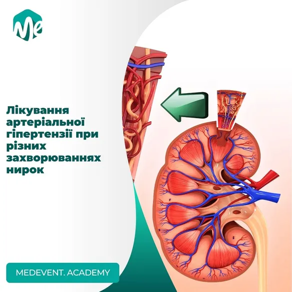 Лікування артеріальної гіпертензії при різних захворюваннях нирок
