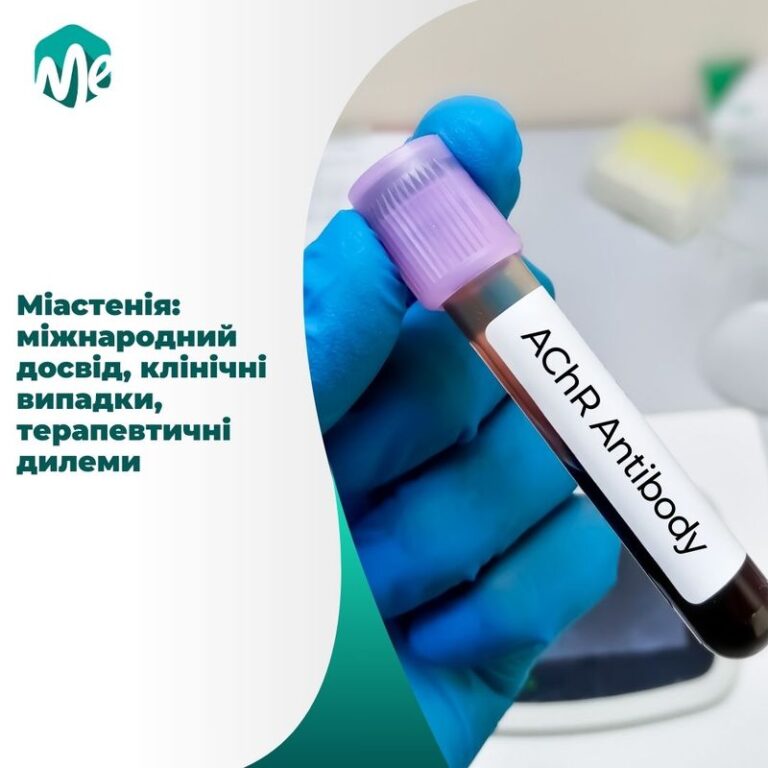 Міастенія: міжнародний досвід, клінічні випадки
