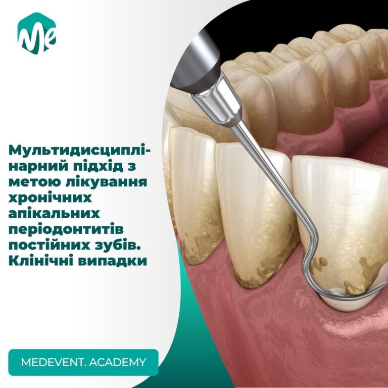 Multydysczypli narnyj pidhid z metoyu likuvannia hronichnyh apikalnyh periodontytiv postijnyh zubiv