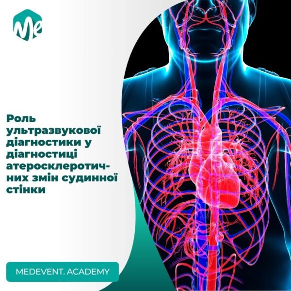 Ультразвукова діагностика атеросклеротичних змін