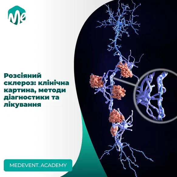 Розсіяний склероз: клінічна картина, методи діагностики та лікування