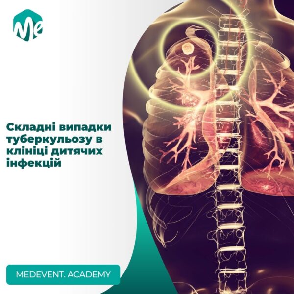 Складні випадки туберкульозу в клініці