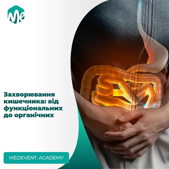 Захворювання кишечника: від функціональних до органічних
