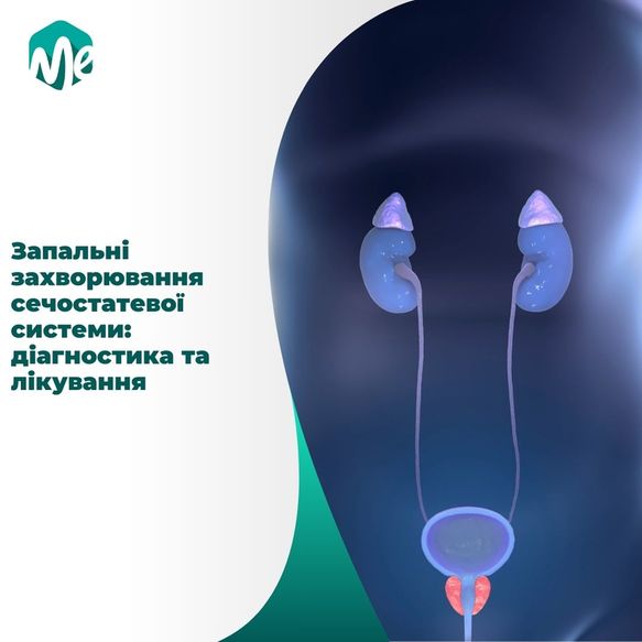 Zapalni zahvoryuvannia sechostatevoi systemy 1 1
